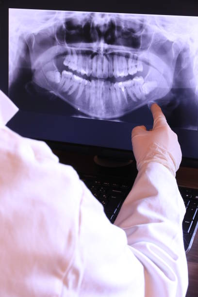 Best Broken or Chipped Tooth Repair in Mora, MN